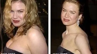 Renee Zellweger