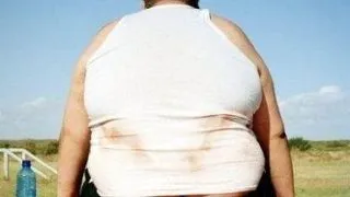 Hipertrigliceridemia - factor de risc cardiovascular