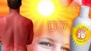 Intrebari despre arsurile solare