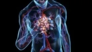 10 cauze si remedii ale hipertensiunii arteriale