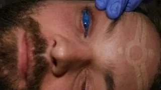 Primul tatuaj pe ochi