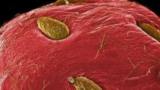Cum arata mancarea noastra vazuta prin microscop - Galerie Foto