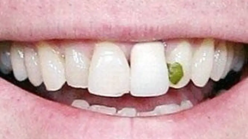 5/52
